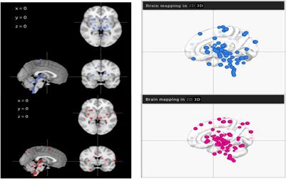 Multi-Data Integration Towards a Global Understanding of the Neurological Impact of Human Brain Severe Acute Respiratory Syndrome Coronavirus 2 Infection